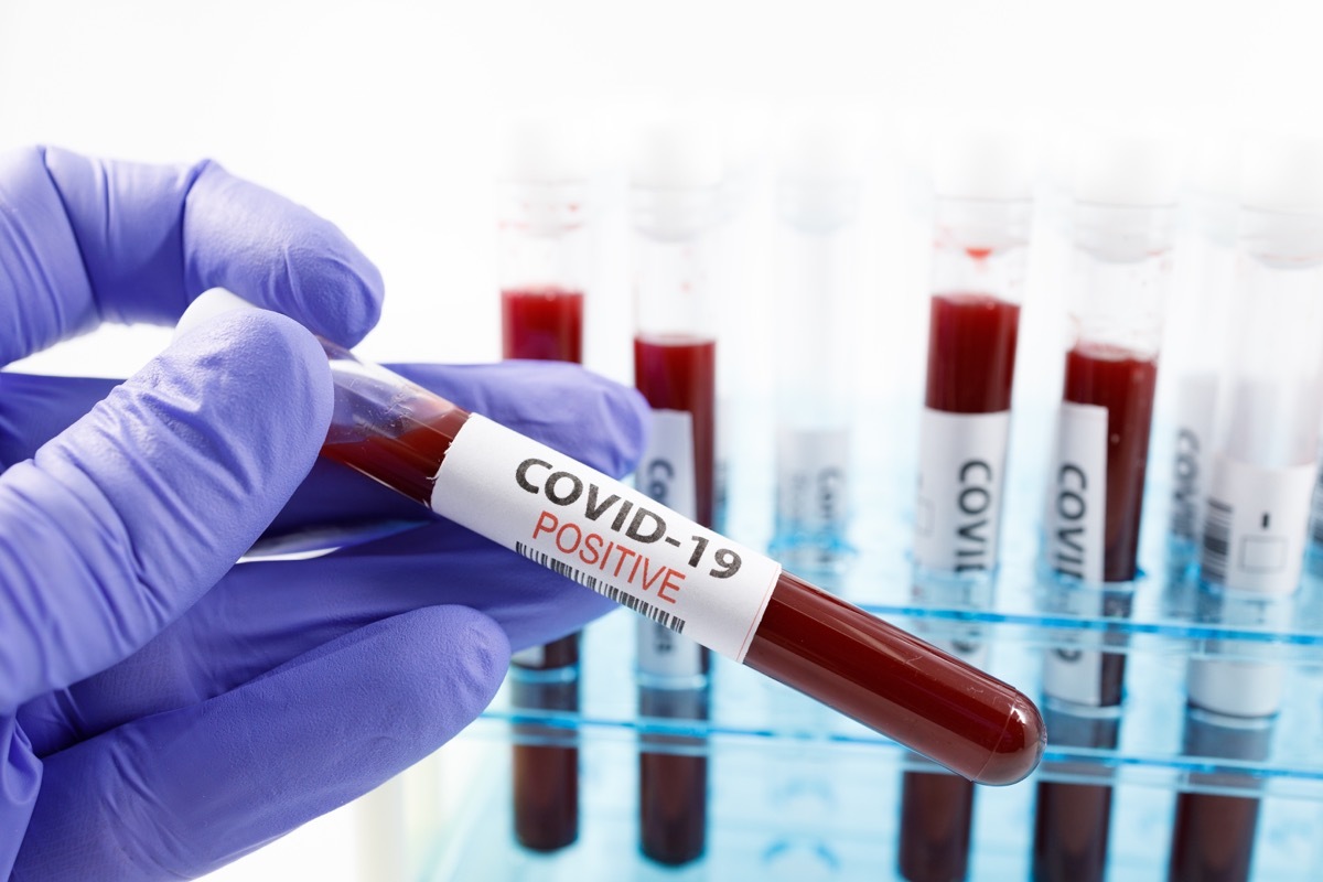 Close up of microbiologist hand with surgical gloves holding a positive blood test result for coronavirus. Test tubes rack with blood sample for covid-19 virus, on white background with copy space.