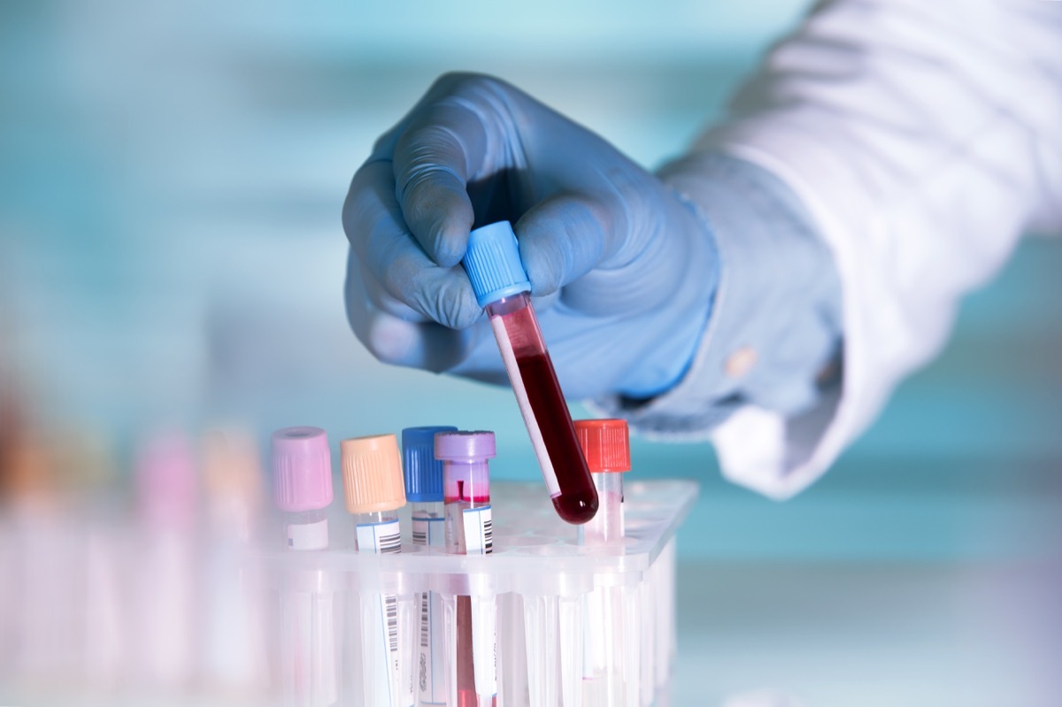 Gloved scientist hand holding blood tests