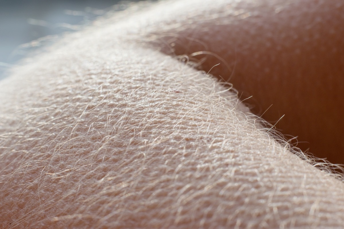 Goosebumps on arm