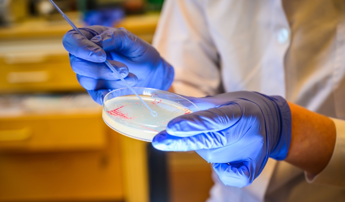 petri dish with e. coli bacteria