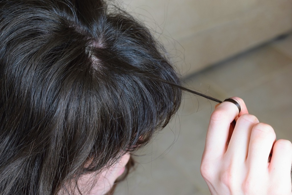 Trichotillomania Hair Thinning