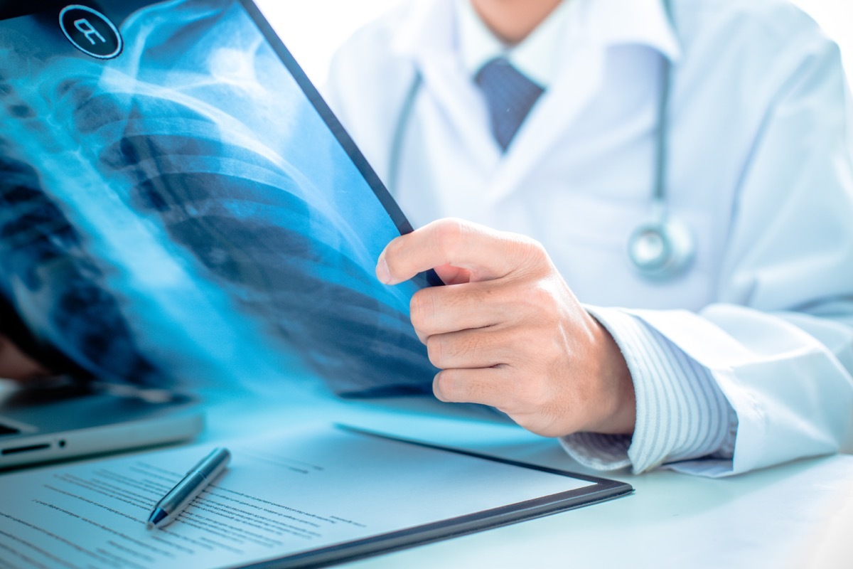 Doctor holding x-ray of the lungs