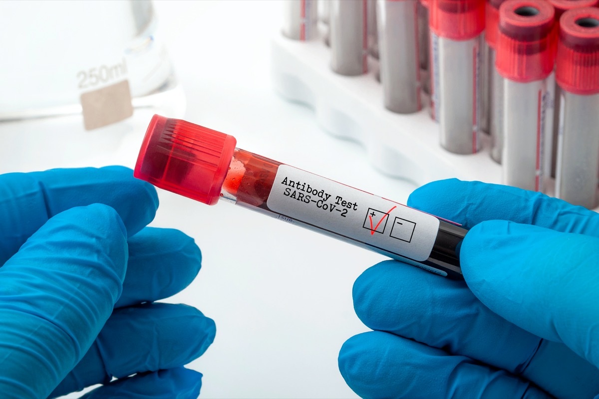 coronavirus antibody test blood vial